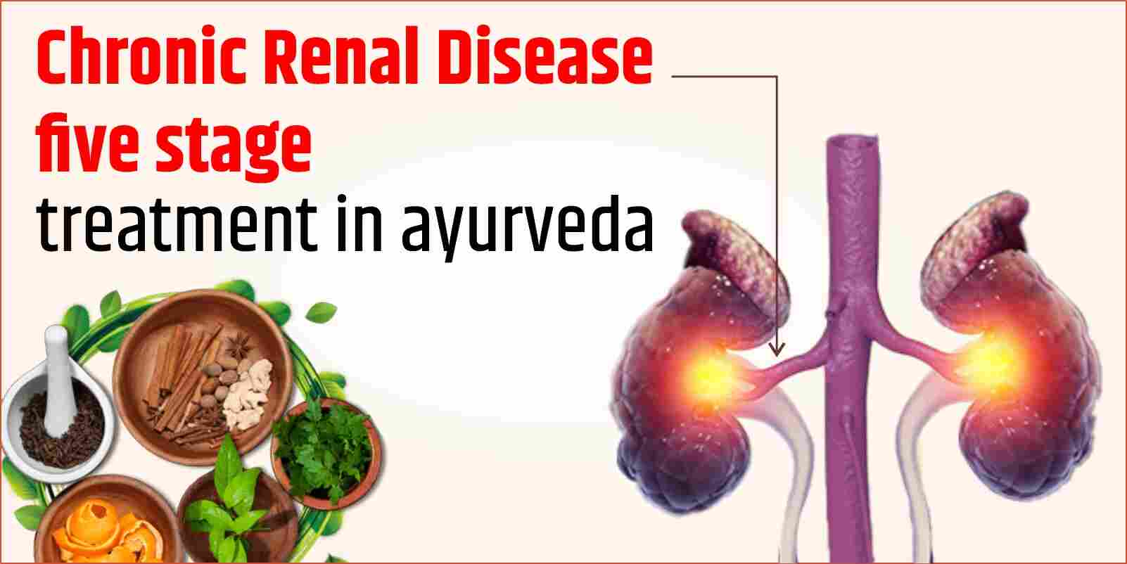 Chronic Renal Disease Five Stage Treatment in Ayurveda